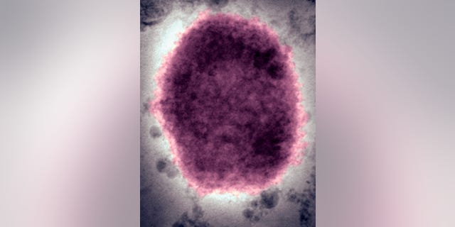 Monkeypox virus present in human vesicular fluid.