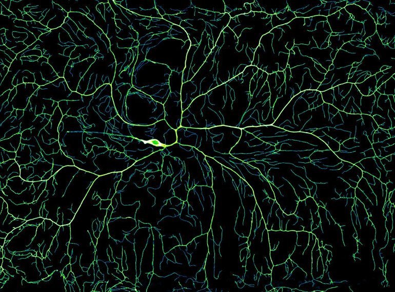 This shows a pattern of dendrite branching